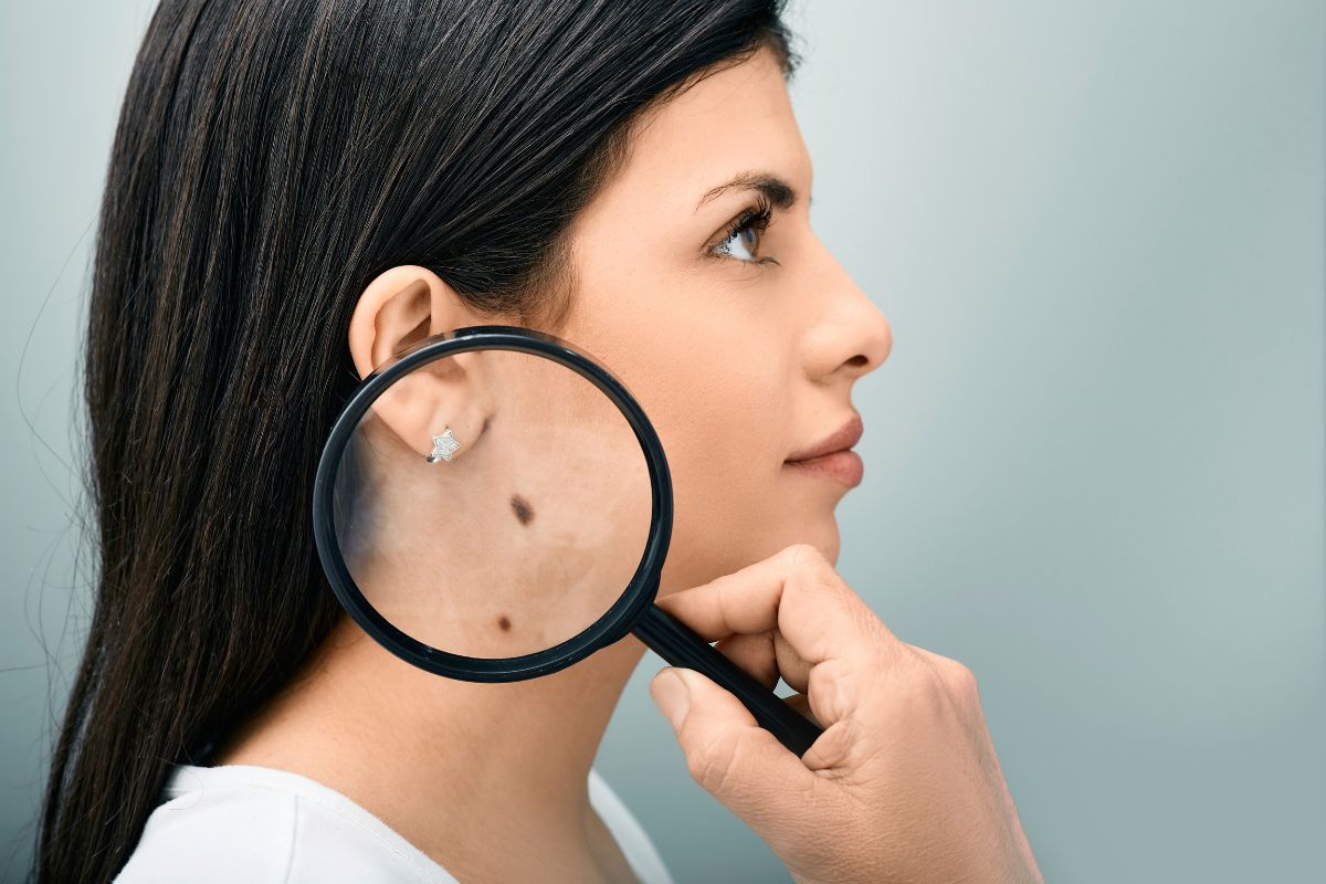 femme qui montre son grain de beauté à enlever à la loupe