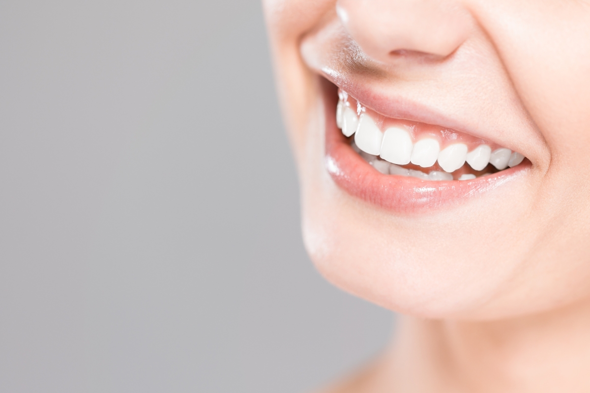 une femme au sourire éclatant et dents blanches